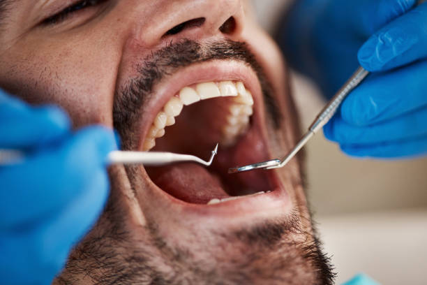 Best Emergency Treatment for Oral Infections in Vernon Center, NJ