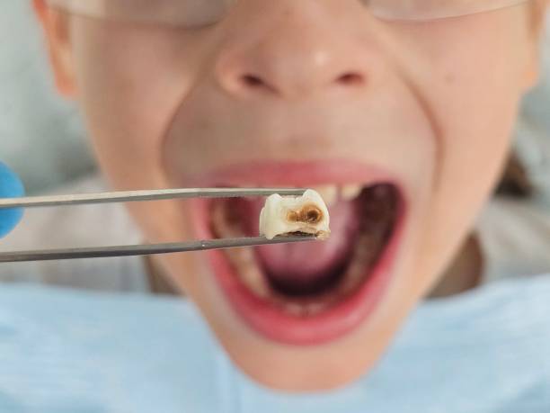 Best Emergency Pediatric Dental Care in Vernon Center, NJ